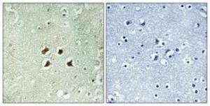 Immunohistochemical analysis of paraffin-embedded human brain using Anti-Huntingtin Antibody 1:100 (4°C overnight). The right hand panel represents a negative control, where the antibody was pre-incubated with the immunising peptide