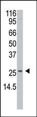 Anti-APH1A Rabbit Polyclonal Antibody (APC (Allophycocyanin))