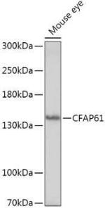 Western blot analysis of extracts of Mouse eye, using Anti-C20orf26 Antibody (A307884) at 1:1,000 dilution The secondary antibody was Goat Anti-Rabbit IgG H&L Antibody (HRP) at 1:10,000 dilution Lysates/proteins were present at 25 µg per lane