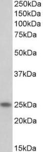 Anti-TNNI1 antibody