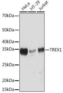 Western blot analysis of extracts of various cell lines, using Anti-TREX1 Antibody [ARC0841] (A305313) at 1:1000 dilution