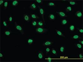 Anti-NFIC Mouse Monoclonal Antibody [clone: 1D6]