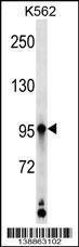 Anti-KAZ Rabbit Polyclonal Antibody (Biotin)