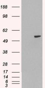 HEK293 overexpressing PAX8A (RC200651) and probed with Anti-PAX8 Antibody (A83459) (mock transfection in first lane), tested by Origene