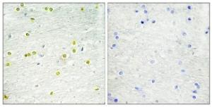 Immunohistochemical analysis of paraffin-embedded human brain tissue using Anti-Histone H3 Antibody. The right hand panel represents a negative control, where the antibody was pre-incubated with the immunising peptide