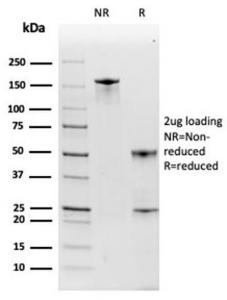 SDS-PAGE analysis of Anti-Haptoglobin Antibody [HP/3835] under non-reduced and reduced conditions; showing intact IgG and intact heavy and light chains, respectively. SDS-PAGE analysis confirms the integrity and purity of the antibody