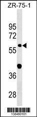 Anti-GDPD2 Rabbit Polyclonal Antibody (HRP (Horseradish Peroxidase))