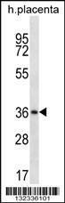 Anti-MUL1 Rabbit Polyclonal Antibody (Biotin)