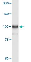 Anti-HOOK1 Polyclonal Antibody Pair