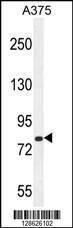 Anti-CB086 Rabbit Polyclonal Antibody (HRP (Horseradish Peroxidase))