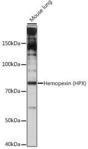 Western blot analysis of extracts of Mouse lung, using Anti-Hemopexin Antibody [ARC1444] (A305314) at 1:1000 dilution