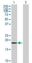 Anti-CAPS1 Rabbit Polyclonal Antibody