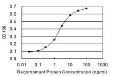 Anti-NFIC Mouse Monoclonal Antibody [clone: 1D6]