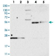 Anti-UNC93A Rabbit Polyclonal Antibody