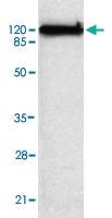 Anti-KIF11 Mouse Monoclonal Antibody