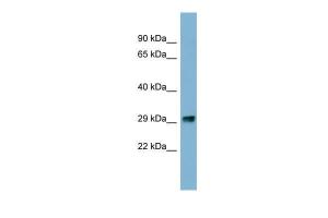 Anti-PRKRIP1 Rabbit Polyclonal Antibody