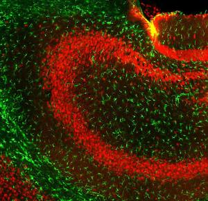 Immunofluorescent analysis of mouse hippocampus section stained with Anti-GFAP Antibody (A270545), at a dilution of 1:5000, in green