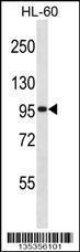 Anti-GTF3C2 Rabbit Polyclonal Antibody (AP (Alkaline Phosphatase))