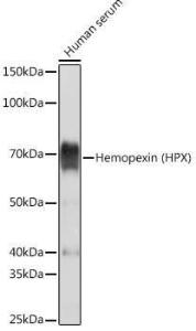 Western blot analysis of extracts of Human serum, using Anti-Hemopexin Antibody [ARC1444] (A305314) at 1:5000 dilution