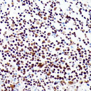 Immunohistochemistry analysis of paraffin-embedded human appendix tissue using Anti-PML Protein Antibody (A309121) at a dilution of 1:100 (40x lens) Perform microwave antigen retrieval with 10 mM PBS buffer pH 72 before commencing with IHC staining protocol