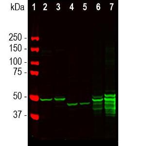 Western blot analysis of brain lysates from different species using Anti-GFAP Antibody (A270545), at a dilution of 1:5000, in green