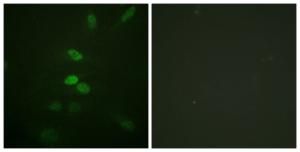 Immunofluorescence analysis of HeLa cells using Anti-CDC25B Antibody The right hand panel represents a negative control, where the antibody was pre-incubated with the immunising peptide