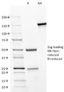 SDS-PAGE analysis of Anti-CD31 Antibody [JC/70A] under non-reduced and reduced conditions; showing intact IgG and intact heavy and light chains, respectively. SDS-PAGE analysis confirms the integrity and purity of the antibody