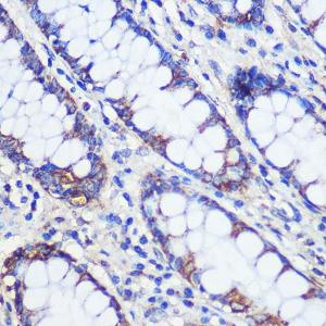 Immunohistochemistry analysis of paraffin-embedded human colon tissue using Anti-C20orf26 Antibody (A307884) at a dilution of 1:100 (40x lens) Perform microwave antigen retrieval with 10 mM PBS buffer pH 72 before commencing with IHC staining protocol