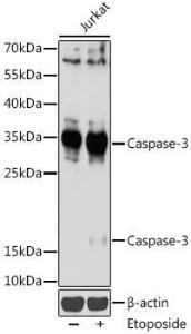 Western blot analysis of extracts of Jurkat cells, using Anti-Caspase-3 Antibody (A93186) at 1:1,000 dilution