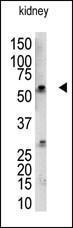 Anti-RBCK1 Rabbit Polyclonal Antibody