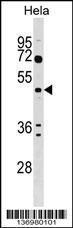 Anti-ALG2 Rabbit Polyclonal Antibody (Biotin)