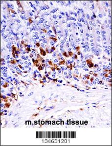 Anti-MAP3K6 Rabbit Polyclonal Antibody (HRP (Horseradish Peroxidase))