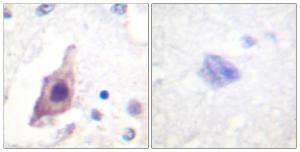 Immunohistochemical analysis of paraffin-embedded human brain tissue using Anti-CDC25B Antibody The right hand panel represents a negative control, where the antibody was pre-incubated with the immunising peptide