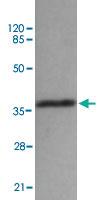 Anti-BMI1 Mouse Monoclonal Antibody