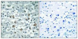 Immunohistochemical analysis of paraffin-embedded human brain using Anti-EIF1AY Antibody 1:100 (4°C overnight). The right hand panel represents a negative control, where the antibody was pre-incubated with the immunising peptide.