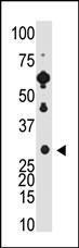 Anti-RCVRN Rabbit Polyclonal Antibody (APC (Allophycocyanin))