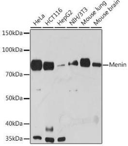 Anti-Menin Rabbit Monoclonal Antibody [clone: ARC1968]