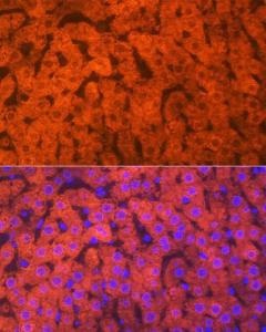 Immunofluorescence analysis of rat liver using Anti-Hemopexin Antibody [ARC1444] (A305314) at a dilution of 1:100 (40x lens). DAPI was used to stain the cell nuclei (blue)