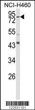 Anti-SPG20 Rabbit Polyclonal Antibody (AP (Alkaline Phosphatase))