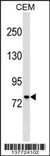 Anti-MUM1 Rabbit Polyclonal Antibody (AP (Alkaline Phosphatase))