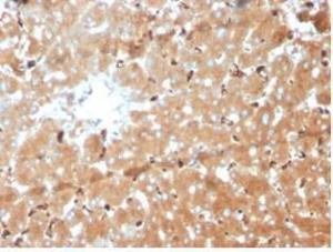 Anti-Haptoglobin Mouse Monoclonal Antibody [clone: HP/3839]