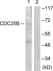 Western blot analysis of lysates from Raw2647 cells, treated with UV 15' using Anti-CDC25B Antibody The right hand lane represents a negative control, where the antibody is blocked by the immunising peptide