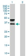 Anti-FUT6 Mouse Polyclonal Antibody