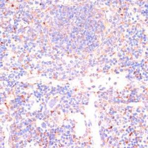 Immunohistochemistry analysis of paraffin-embedded mouse spleen using Anti-Caspase-3 Antibody (A93186) at a dilution of 1:200 (40X lens). Perform microwave antigen retrieval with 10 mM PBS buffer pH 7.2 before commencing with IHC staining protocol