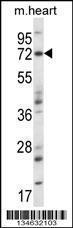 Anti-MAP3K7 Rabbit Polyclonal Antibody (Biotin)