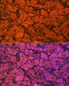 Immunofluorescence analysis of human liver using Anti-Hemopexin Antibody [ARC1444] (A305314) at a dilution of 1:100 (40x lens). DAPI was used to stain the cell nuclei (blue)