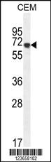 Anti-AMY2B Rabbit Polyclonal Antibody