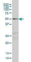 Anti-NFIC Mouse Monoclonal Antibody [clone: 2B6]