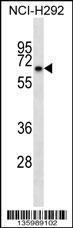 Anti-KLHL41 Rabbit Polyclonal Antibody (APC (Allophycocyanin))