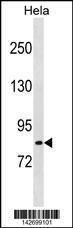 Anti-LRCH1 Rabbit Polyclonal Antibody (Biotin)